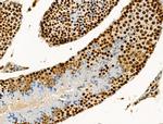 Phospho-NPM1 (Ser125) Antibody in Immunohistochemistry (Paraffin) (IHC (P))