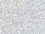 Phospho-NPM1 (Ser125) Antibody in Immunohistochemistry (Paraffin) (IHC (P))