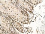 Phospho-NPM1 (Ser125) Antibody in Immunohistochemistry (Paraffin) (IHC (P))