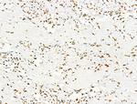 Phospho-NPM1 (Ser125) Antibody in Immunohistochemistry (Paraffin) (IHC (P))