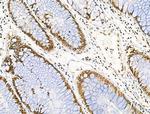 Phospho-NPM1 (Ser125) Antibody in Immunohistochemistry (Paraffin) (IHC (P))