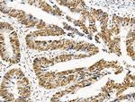 Phospho-NPM1 (Ser125) Antibody in Immunohistochemistry (Paraffin) (IHC (P))