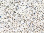 Phospho-NPM1 (Ser125) Antibody in Immunohistochemistry (Paraffin) (IHC (P))