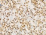 Phospho-NPM1 (Ser125) Antibody in Immunohistochemistry (Paraffin) (IHC (P))