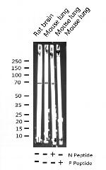 Phospho-p70 S6 Kinase (Thr252) Antibody in Western Blot (WB)