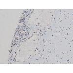 Phospho-p70 S6 Kinase (Thr252) Antibody in Immunohistochemistry (Paraffin) (IHC (P))