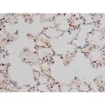 Phospho-p70 S6 Kinase (Thr252) Antibody in Immunohistochemistry (Paraffin) (IHC (P))