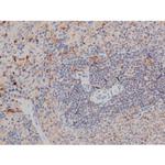 Phospho-p70 S6 Kinase (Thr252) Antibody in Immunohistochemistry (Paraffin) (IHC (P))