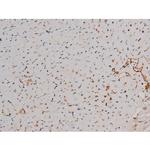 Phospho-p70 S6 Kinase (Thr252) Antibody in Immunohistochemistry (Paraffin) (IHC (P))