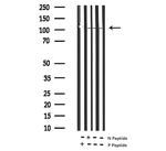 Phospho-PDGFRB (Tyr1021) Antibody in Western Blot (WB)