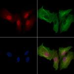 Phospho-PFKFB3 (Ser461) Antibody in Immunocytochemistry (ICC/IF)