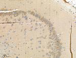 Phospho-PFKFB3 (Ser461) Antibody in Immunohistochemistry (Paraffin) (IHC (P))