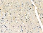 Phospho-PFKFB3 (Ser461) Antibody in Immunohistochemistry (Paraffin) (IHC (P))