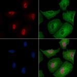 Phospho-PP1 alpha (Thr320) Antibody in Immunocytochemistry (ICC/IF)