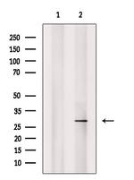 Phospho-RAB29 (Thr71) Antibody in Western Blot (WB)