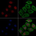 Phospho-RB1 (Ser780) Antibody in Immunocytochemistry (ICC/IF)