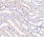 Phospho-RB1 (Ser780) Antibody in Immunohistochemistry (Paraffin) (IHC (P))