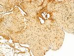 Phospho-RB1 (Ser780) Antibody in Immunohistochemistry (Paraffin) (IHC (P))