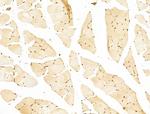 Phospho-RB1 (Ser780) Antibody in Immunohistochemistry (Paraffin) (IHC (P))