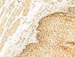 Phospho-RB1 (Ser780) Antibody in Immunohistochemistry (Paraffin) (IHC (P))