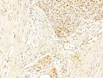 Phospho-RB1 (Ser780) Antibody in Immunohistochemistry (Paraffin) (IHC (P))