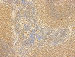 Phospho-RB1 (Ser780) Antibody in Immunohistochemistry (Paraffin) (IHC (P))