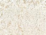 Phospho-RB1 (Ser780) Antibody in Immunohistochemistry (Paraffin) (IHC (P))