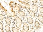 Phospho-RB1 (Ser780) Antibody in Immunohistochemistry (Paraffin) (IHC (P))