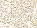 Phospho-RB1 (Ser780) Antibody in Immunohistochemistry (Paraffin) (IHC (P))