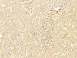 Phospho-RB1 (Ser780) Antibody in Immunohistochemistry (Paraffin) (IHC (P))