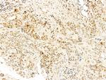 Phospho-RB1 (Ser780) Antibody in Immunohistochemistry (Paraffin) (IHC (P))