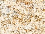 Phospho-RB1 (Ser780) Antibody in Immunohistochemistry (Paraffin) (IHC (P))