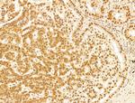 Phospho-RB1 (Ser780) Antibody in Immunohistochemistry (Paraffin) (IHC (P))