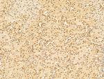 Phospho-RB1 (Ser780) Antibody in Immunohistochemistry (Paraffin) (IHC (P))