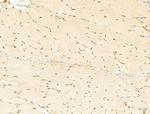 Phospho-RB1 (Ser780) Antibody in Immunohistochemistry (Paraffin) (IHC (P))