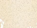 Phospho-RB1 (Ser780) Antibody in Immunohistochemistry (Paraffin) (IHC (P))