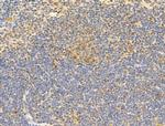 Phospho-RB1 (Ser780) Antibody in Immunohistochemistry (Paraffin) (IHC (P))