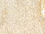 Phospho-RB1 (Ser780) Antibody in Immunohistochemistry (Paraffin) (IHC (P))