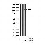 Phospho-RB1 (Ser780) Antibody in Western Blot (WB)