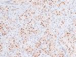 Phospho-RB1 (Ser788) Antibody in Immunohistochemistry (Paraffin) (IHC (P))