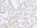 Phospho-RB1 (Ser788) Antibody in Immunohistochemistry (Paraffin) (IHC (P))