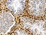 Phospho-RSK Pan (Ser221, Ser227, Ser218, Ser232) Antibody in Immunohistochemistry (Paraffin) (IHC (P))