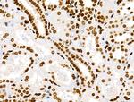 Phospho-RSK Pan (Ser221, Ser227, Ser218, Ser232) Antibody in Immunohistochemistry (Paraffin) (IHC (P))