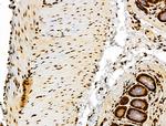 Phospho-RSK Pan (Ser221, Ser227, Ser218, Ser232) Antibody in Immunohistochemistry (Paraffin) (IHC (P))