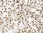 Phospho-RSK Pan (Ser221, Ser227, Ser218, Ser232) Antibody in Immunohistochemistry (Paraffin) (IHC (P))