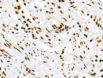 Phospho-RSK Pan (Ser221, Ser227, Ser218, Ser232) Antibody in Immunohistochemistry (Paraffin) (IHC (P))