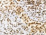 Phospho-RSK Pan (Ser221, Ser227, Ser218, Ser232) Antibody in Immunohistochemistry (Paraffin) (IHC (P))