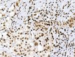 Phospho-RSK Pan (Ser221, Ser227, Ser218, Ser232) Antibody in Immunohistochemistry (Paraffin) (IHC (P))