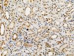 Phospho-SAMHD1 (Thr592) Antibody in Immunohistochemistry (Paraffin) (IHC (P))