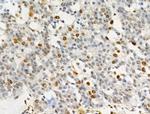 Phospho-SAMHD1 (Thr592) Antibody in Immunohistochemistry (Paraffin) (IHC (P))